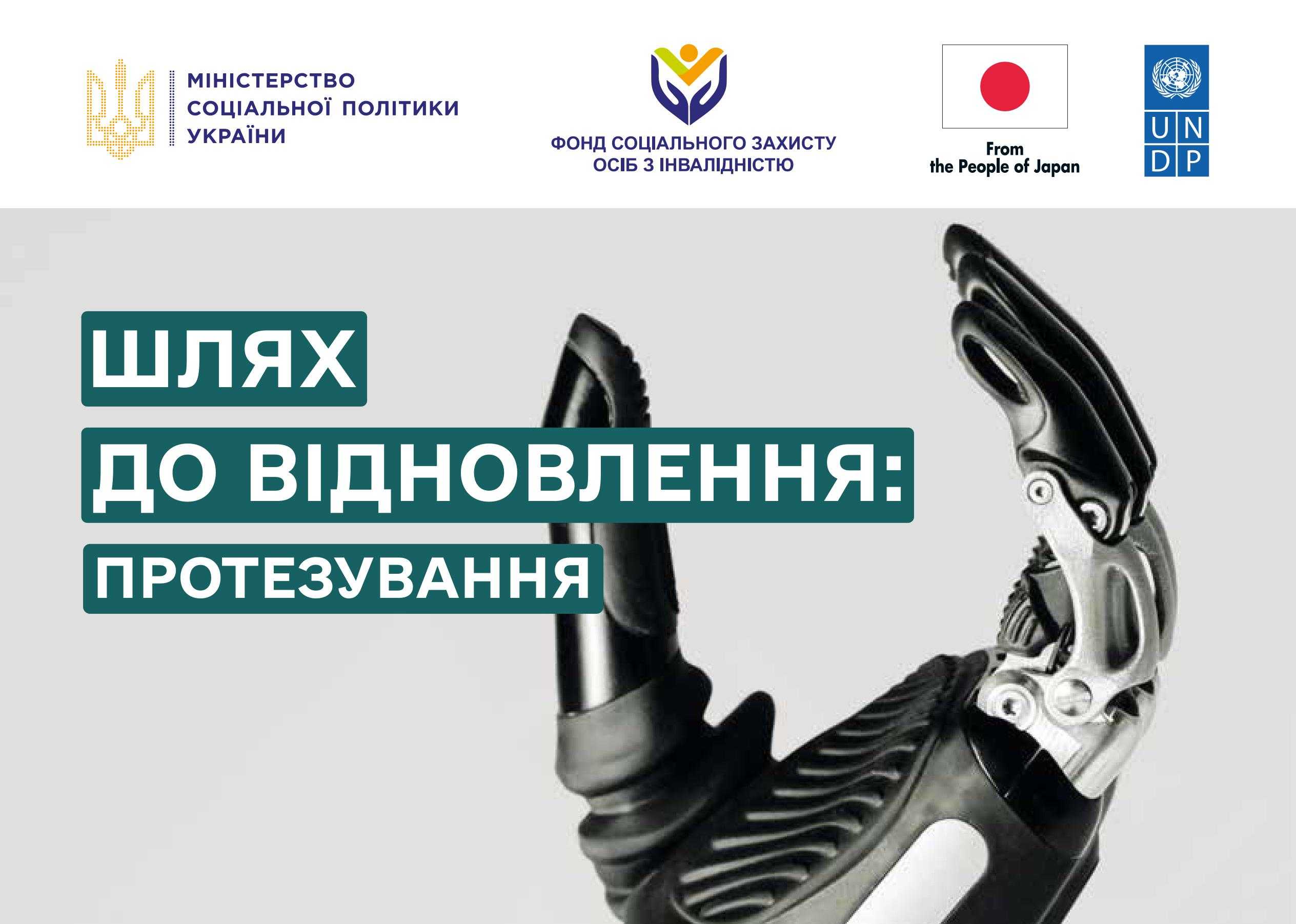 Шлях до відновлення: протезування